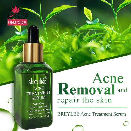 acne serum